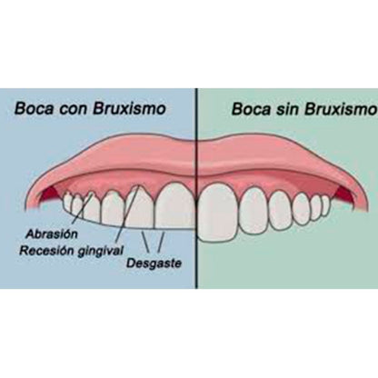 Placa Bruxismo Placa De Silicona Anti Bruxismo Duerme Mejor